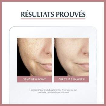 Eucerin ANTI-PIGMENT SERUM DUO 30 ML + Ecran pigment spf50 OFFERT