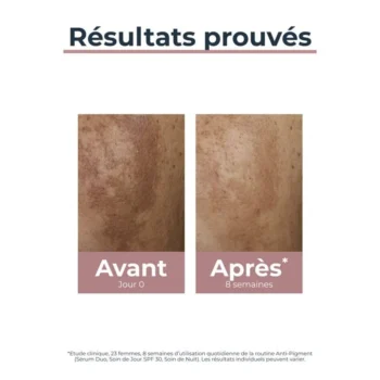 Eucerin ANTI-PIGMENT SOIN DE JOUR SPF 30 – 50 ML