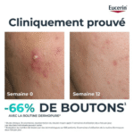 EUCERIN DERMOPURE TRIPLE ACTION SERUM