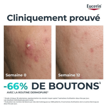 EUCERIN DERMOPURE TRIPLE ACTION SERUM