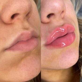 VOLULIPS Plumper Repulpant Lèvres